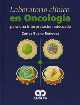 Imagen de Laboratorio clínico de oncología