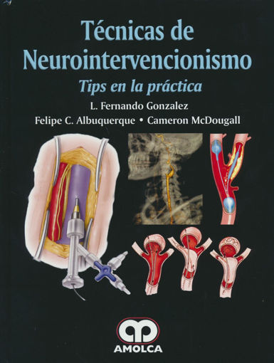 Imagen de Técnicas de neurointervencionismo Tips en la práctica