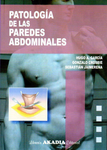 Imagen de Patología de las paredes abdominales
