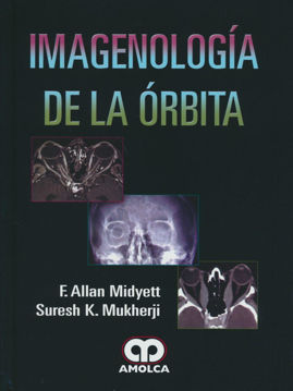 Imagen de Imagenología de la Órbita