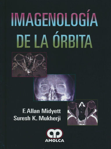 Imagen de Imagenología de la Órbita