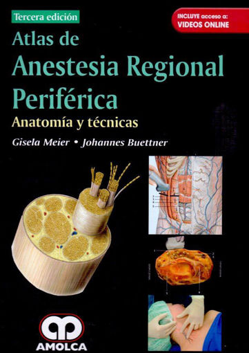 Imagen de Atlas de anestesia regional periférica