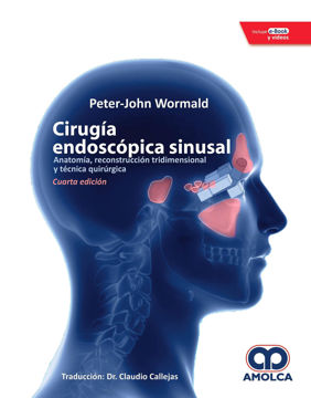 Imagen de Cirugia Endoscopica Sinusal Anatomia