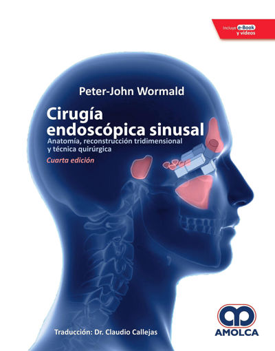 Imagen de Cirugia Endoscopica Sinusal Anatomia