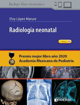 Imagen de Radiologia neonatal
