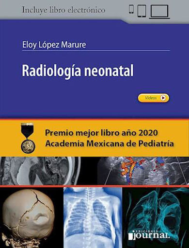 Imagen de Radiologia neonatal
