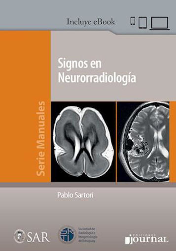 Imagen de Signos en Neurorradiología