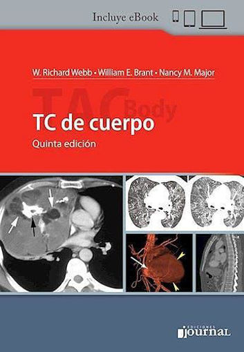 Imagen de TC de Cuerpo