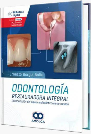Imagen de Odontologia restauradora integral. Rehabilitacion del diente endodonticamente tratado