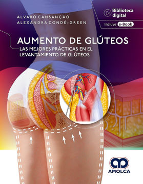 Imagen de Aumento de glúteos Las mejores prácticas en el levantamiento de glúteos.