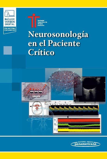 Imagen de Neurosonología en el paciente crítico