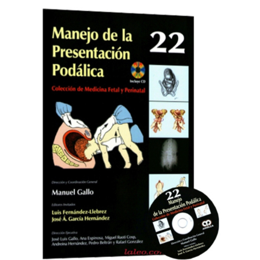 Imagen de Manejo de la presentación podálgica