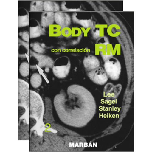 Imagen de Body TC con Correlación RM 2 vols