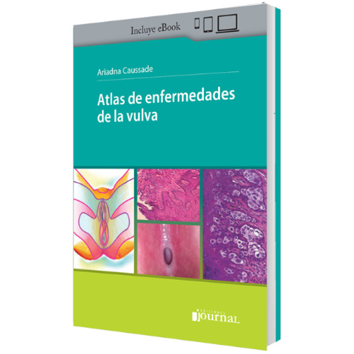Imagen de Atlas de enfermedades de la vulva