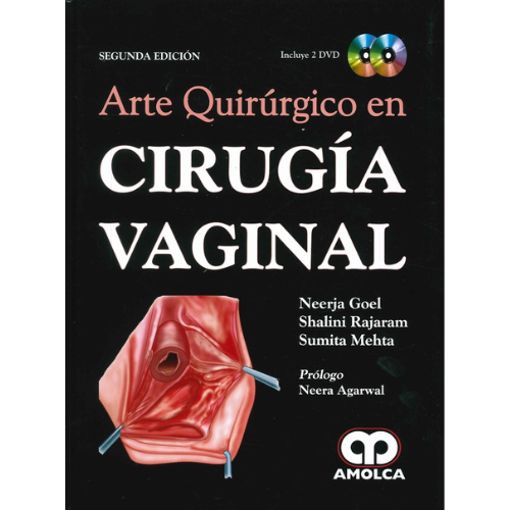 Imagen de Arte quirúrgico en cirugía vaginal