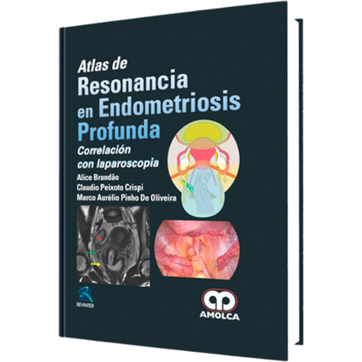 Imagen de Atlas de resonancia en endometriosis profunda