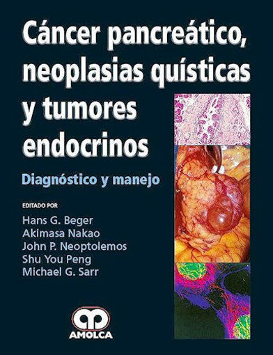 Imagen de Cáncer Pancreático neoplasias quísticas y tumores endocrinos