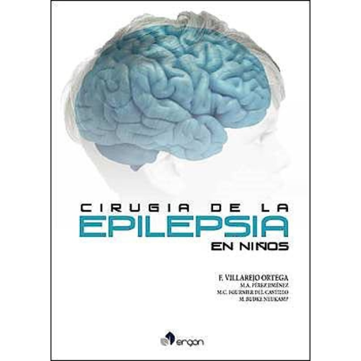 Imagen de Cirugía de la epilepsia en niños