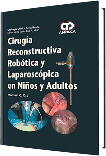 Imagen de Cirugía reconstructiva robótica y laparoscópica en niños y adultos
