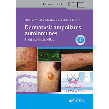 Imagen de Dermatosis ampollares autoinmunes Haga su diagnóstico