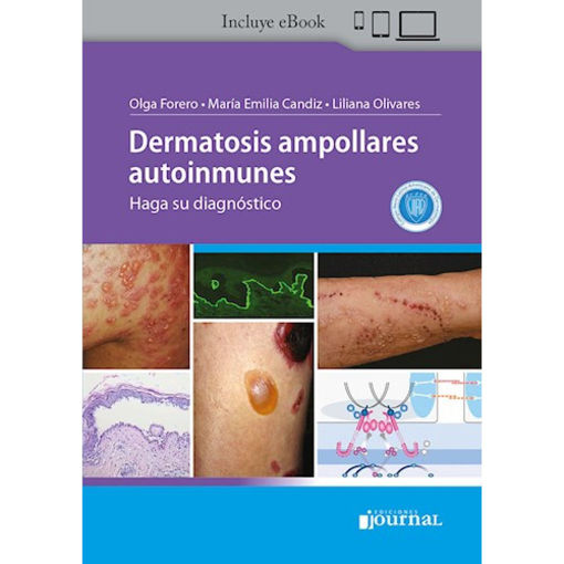 Imagen de Dermatosis ampollares autoinmunes Haga su diagnóstico