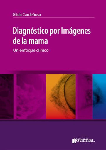 Imagen de Diagnóstico por Imágenes de la mama