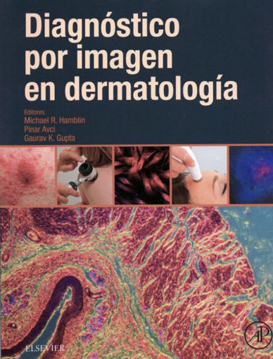Imagen de Diagnóstico por imagen en dermatología