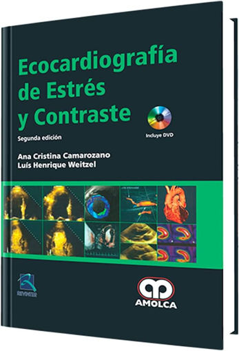 Imagen de Ecocardiografía de Estrés y Contraste
