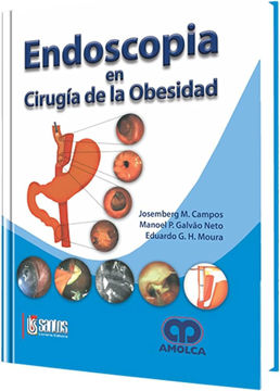 Imagen de Endoscopia en cirugía de la obesidad
