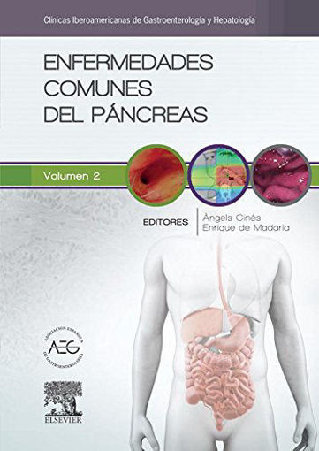 Imagen de Enfermedades comunes del páncreas