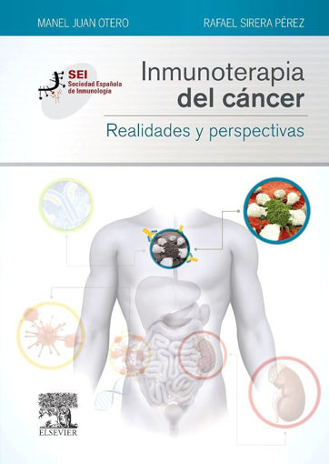 Imagen de Inmunoterapia del cáncer Realidades y perspectivas