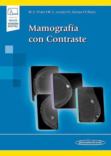 Imagen de Mamografía con Contraste