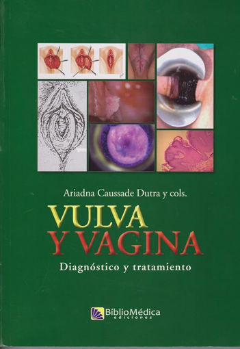 Imagen de Vulva y vagina Diagnóstico y tratamiento.