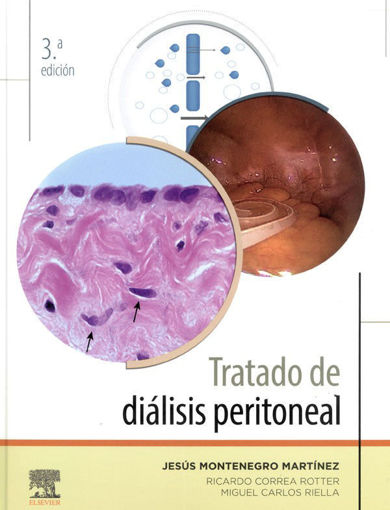Imagen de Tratado de diálisis peritoneal