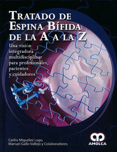 Imagen de Tratado de espina bífida de la  A a la Z