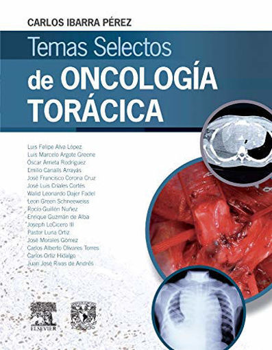 Imagen de Temas selectos de oncología torácica