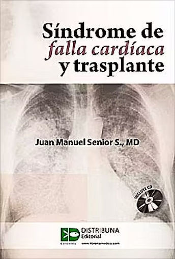 Imagen de Síndrome de Falla Cardíaca y Trasplante