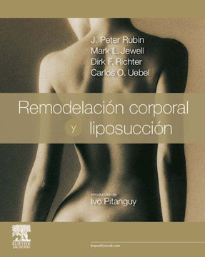 Imagen de Remodelación corporal y liposucción