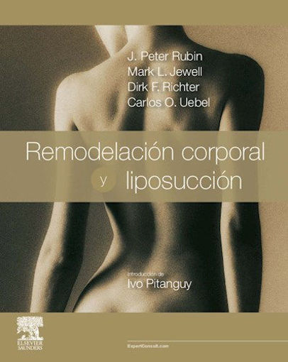 Imagen de Remodelación corporal y liposucción