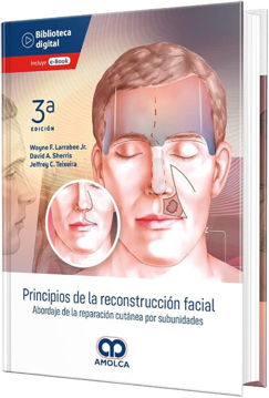 Imagen de Principios de la reconstrucción facial Abordaje de la reparación cutánea por subunidades