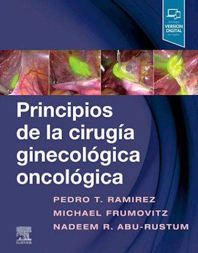 Imagen de Principios de la cirugía ginecológica oncológica