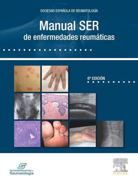 Imagen de Manual SER de enfermedades reumáticas
