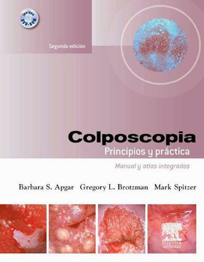 Imagen de Colposcopia Principios y prácticas