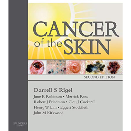 Imagen de Cancer of the skin