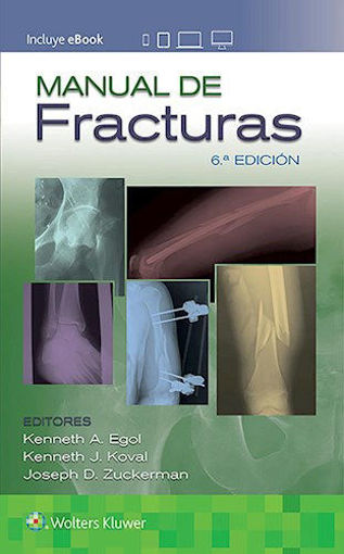 Imagen de Manual de fracturas