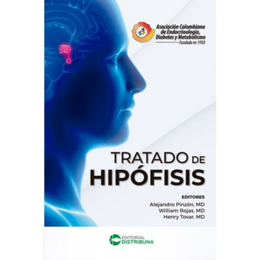 Imagen de Tratado de hipófisis