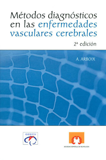 Imagen de Métodos diagnósticos en enfermedades vasculares cerebrales
