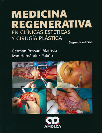 Imagen de Medicina regenerativa en clínicas estéticas y cirugía plástica