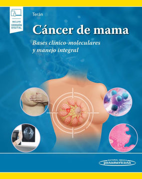 Imagen de Cancer de mama  Bases clinico-moleculares y manejo integral