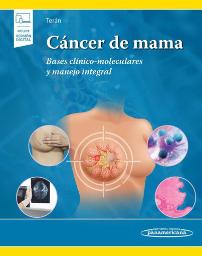 Imagen de Cancer de mama  Bases clinico-moleculares y manejo integral